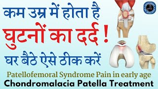 कम उम्र में घुटनों का दर्द ठीक करें, #Chondromalacia Patella Treatment by Exercise in Hindi