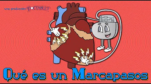 ¿Cuál es el marcapasos más nuevo?