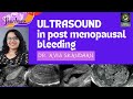 Usg in post menopausal bleeding  dr avni skandhan   sonobuzz sonographer