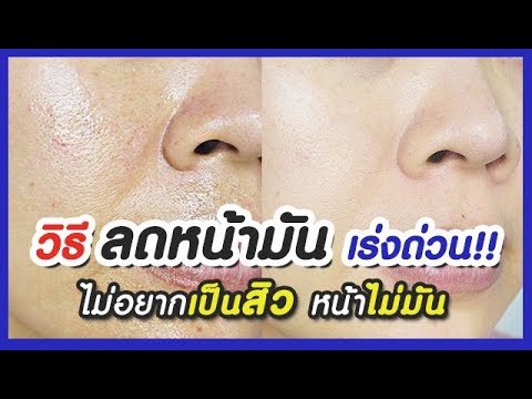 วิธีลดหน้ามัน (เร่งด่วน) ไม่อยากเป็นสิว ต้องดู! สูตรพอกหน้าลดหน้ามันได้ผลจริง 100% Reduce Oily Skin