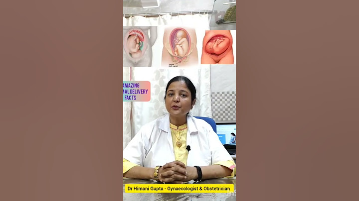 Amazing Normal Delivery Facts|Fetal Presenting Part- Normal Labor| Dr Himani Gupta - Gynaecologist