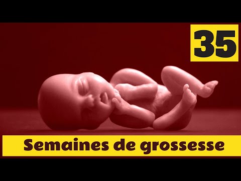 Vidéo: À Quoi Ressemble Un Bébé à 35 Semaines De Gestation