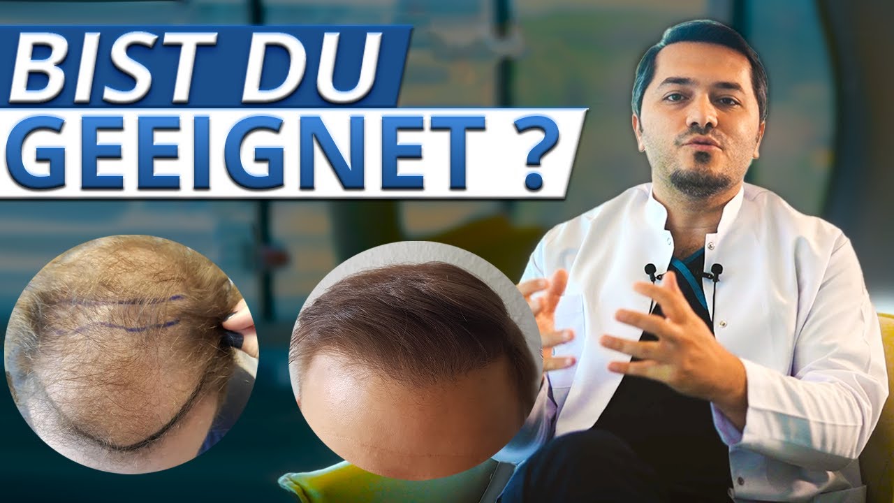 Haartransplantation - Wie dicht können die Haare transplantiert werden?