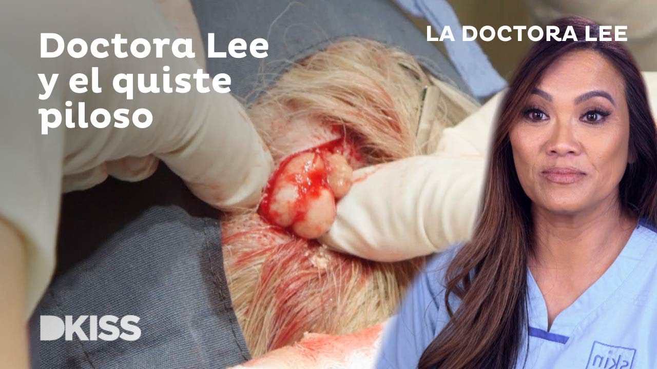 Reventar granos dra lee
