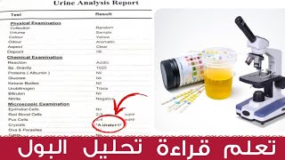 ازاي نقرأ تحليل البول بسهوله | معرفه النسب الطبيعيه لتحليل البول | urine analysis