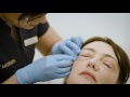 Carboxy Therapy at EF MEDISPA