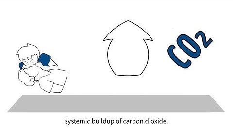 MedEd capnography byte 10: Return of spontaneous circulation (ROSC)
