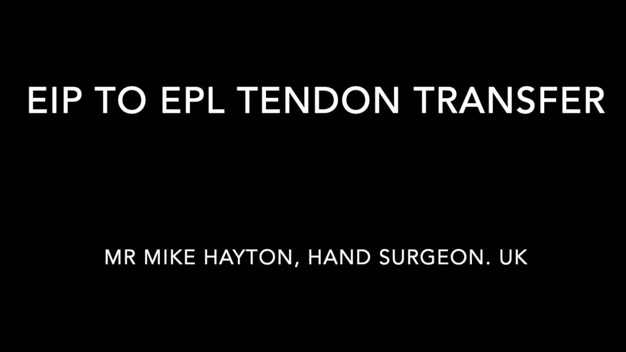 Thumb tendon transfer - EIP to EPL