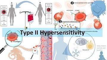 Type II hypersensitivity