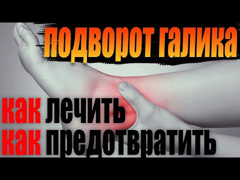 Видео: 3 способа предотвратить травмы лодыжки