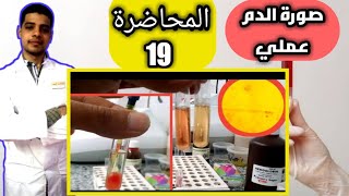 تحليل صورة الدم الكاملة عملي manual complete blood count