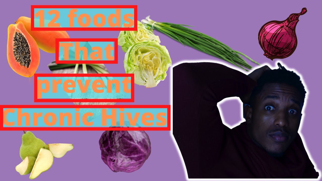 12 Foods That Reduce & Prevent Hives YouTube