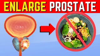 10 Foods to Avoid for a Healthy Prostate