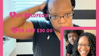 Alopecia coverup|  hair loss | Quick & easy| Full coverage crochet braid|Detailed|alopecia hack