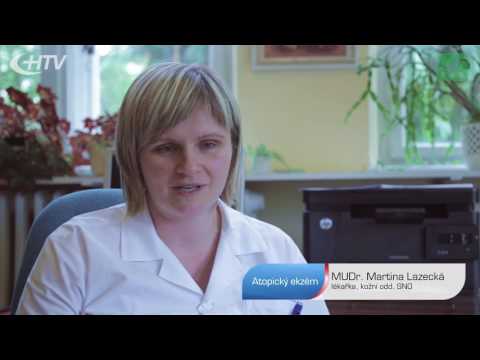 Video: Rozdiel Medzi Atopickou Dermatitídou A Kontaktnou Dermatitídou