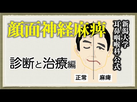 顔面神経麻痺の診断と治療