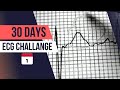 Day 1 know your expertise in ecg interpretation  30day ecg challenge