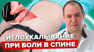 Покончите с БОЛЕВЫМИ ощущениями: Как сеанс АКУПУНКТУРЫ в Клинике Длина помогает при боли в спине