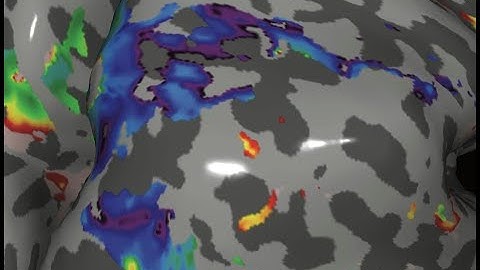 Distributed range adaptation: Adaptive efficient coding of numerosity in parietal cortex