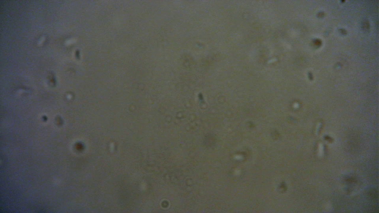 Salmonella motility YouTube