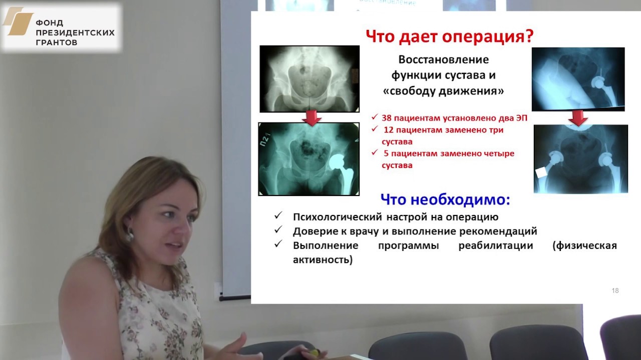 Операция на доверии 5. Болезнь Бехтерева ревматолог. Болезнь Бехтерева пациенты. Болезнь Бехтерева фото пациентов.