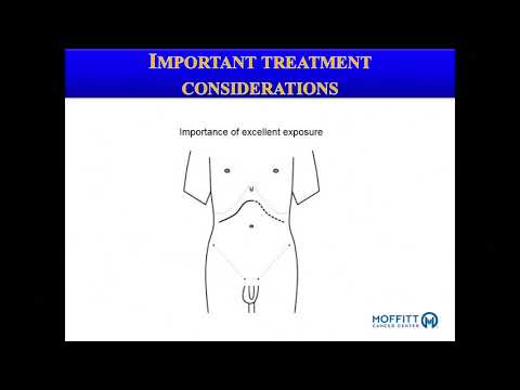 Video: Radioterapi Untuk Trombus Tumor Vena Cava Inferior Pada Pesakit Dengan Karsinoma Hepatoselular