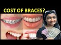 COST OF BRACES IN INDIA |Dental braces-ceramic braces-metal braces-clear aligners-lingual braces
