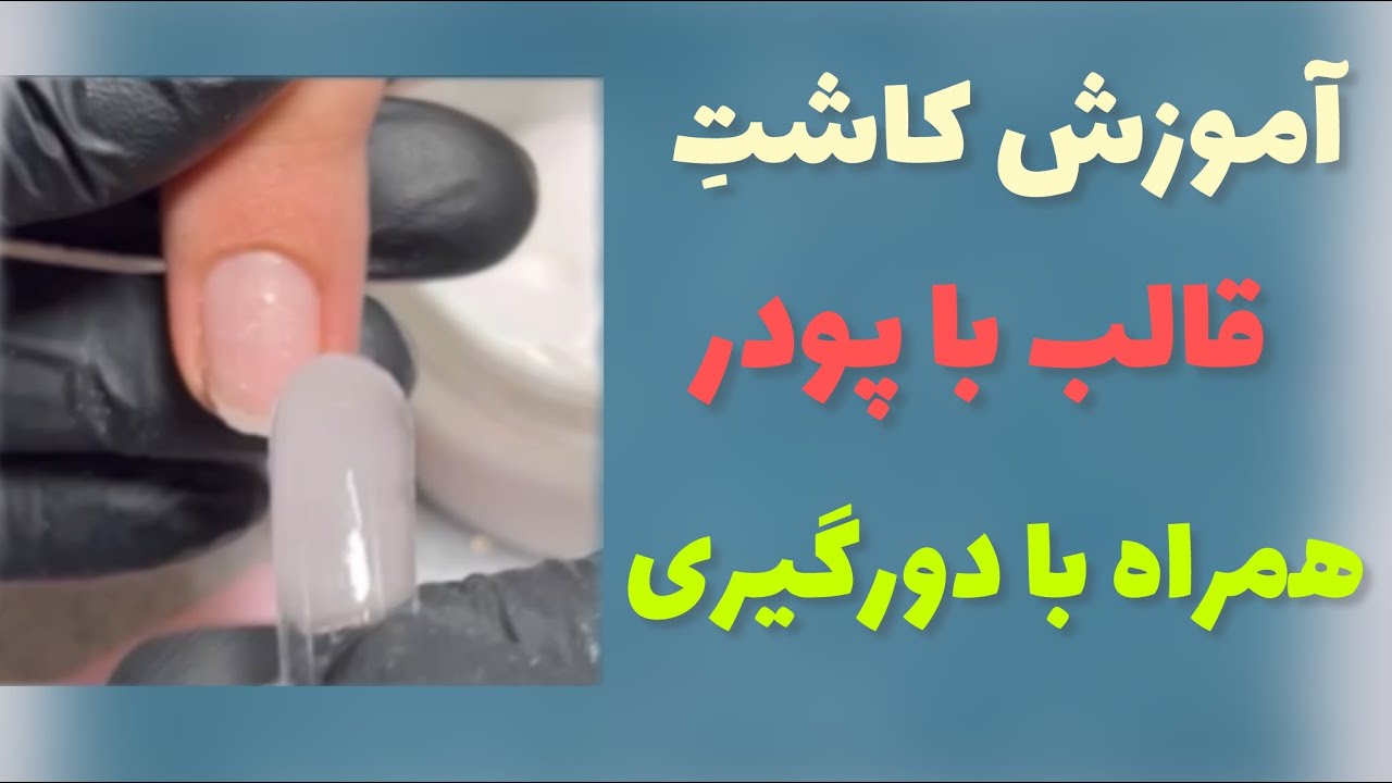 کاشت قالب با پودر، رازهای ماندگاری کاشت قالب( دورگیری کاشت قالب)