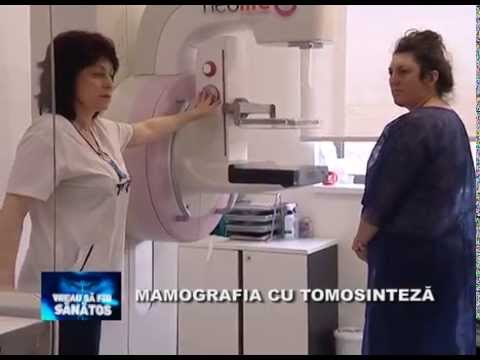 Vreau să fiu sănătos: mamograful cu tomosinteza
