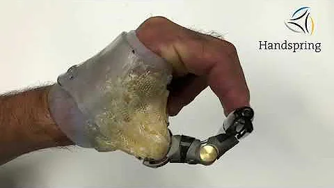 George's Thumb Prosthesis