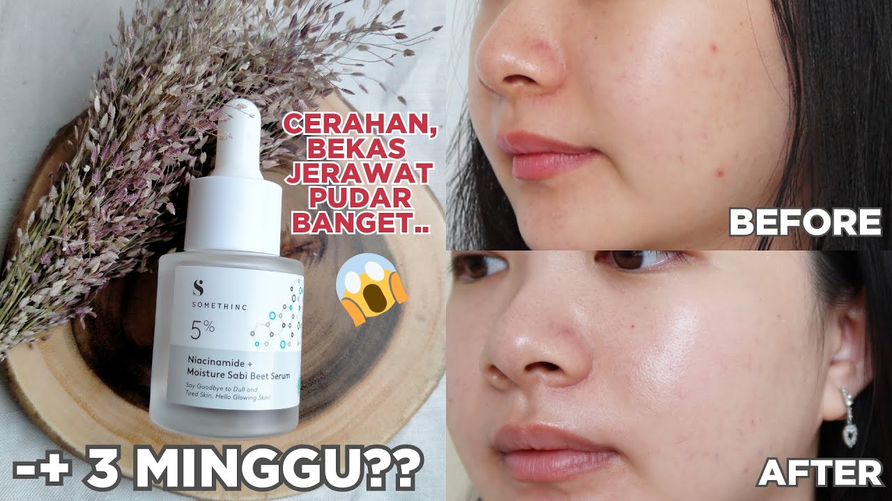 Serum somethinc untuk flek hitam