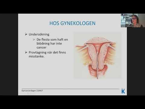 Video: Endometriecancer I Livmodern - Orsaker, Stadier, Symtom, Behandling