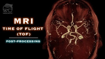 MRI – TOF – POST-PROCESSING