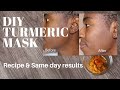 Turmeric face mask for dark spots | DIY recipe for clear skin (Same day results!)