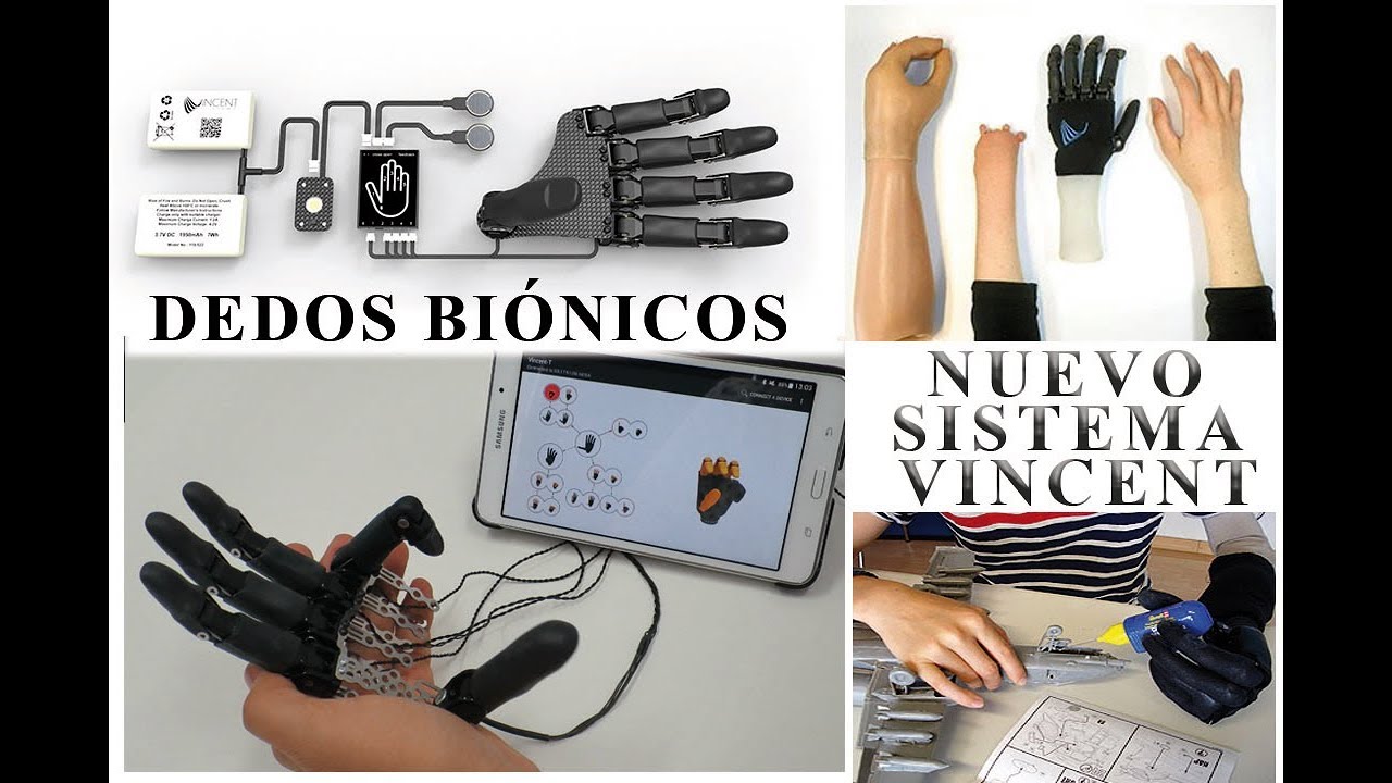 Dedos biónicos Vincent Systems para amputaciones parciales de mano