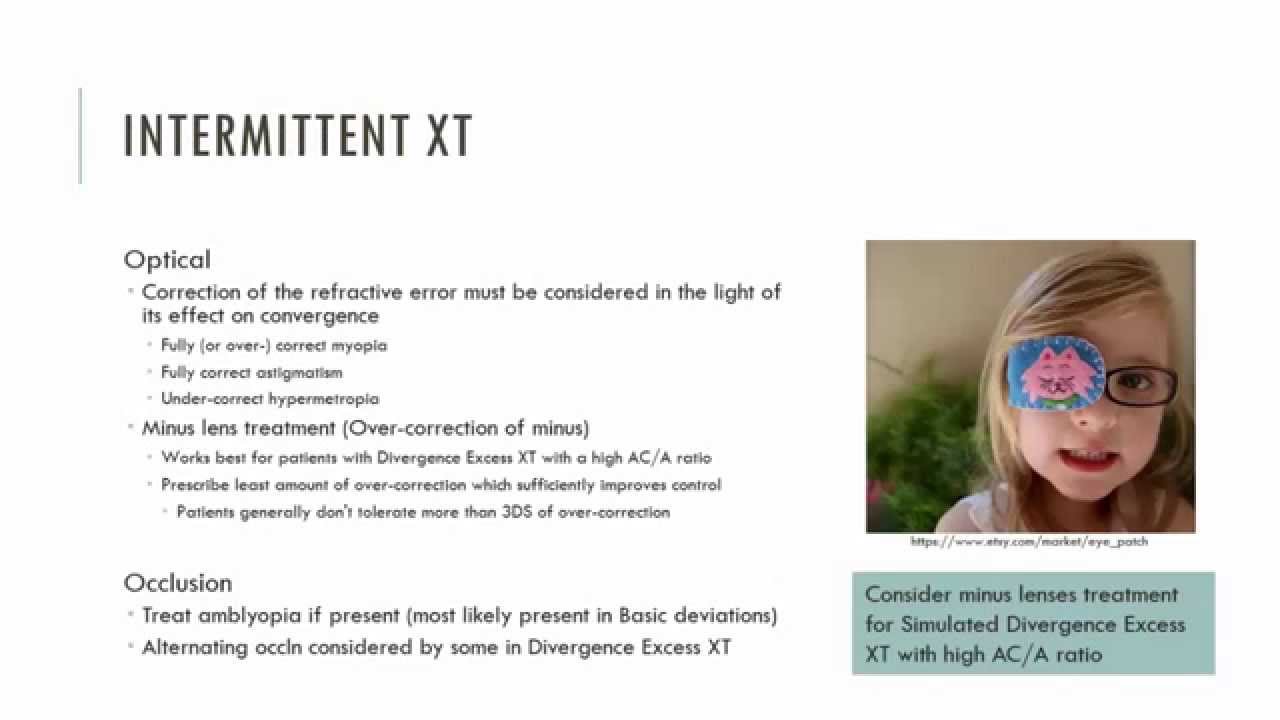 Intermittent Exotropia Management Youtube