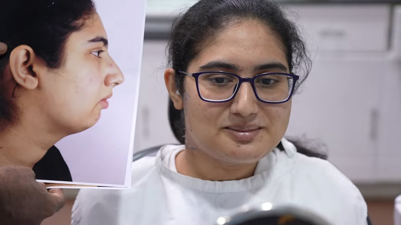 Pack Removal after Jaw Surgery Heavy Swelling Day 7 YouTube