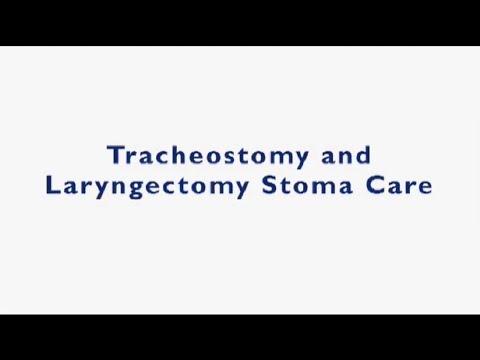 Video: Da li je traheostomija stoma?