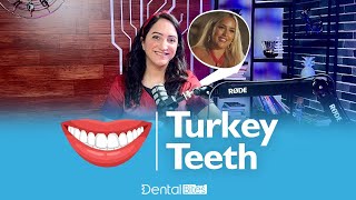 Turkey Teeth!!