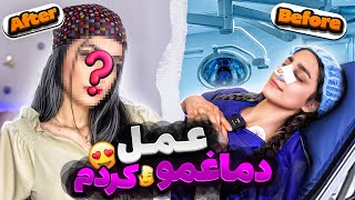 دماغمو عمل کردم 😱👃 چه شکلی شدم ⁉️