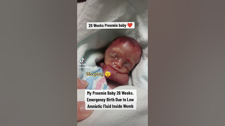 Preemie baby of 26 Weeks #baby #pregnancy #preemiebaby #preemie