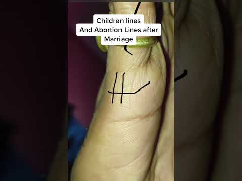 Children and Abortion