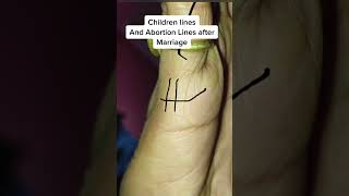 Children And Abortion Lines In Palm Reading Female