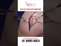 Rotator Cuff Repair Surgery | Shoulder Pain Treatment #scihospital #rotatorcuff #sportsinjury