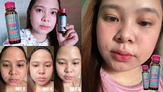 EFFECTIVE BA TALAGA?! (THE DIETCOACH ULTRA COLLAGEN DRINK) HONEST REVIEW!!!