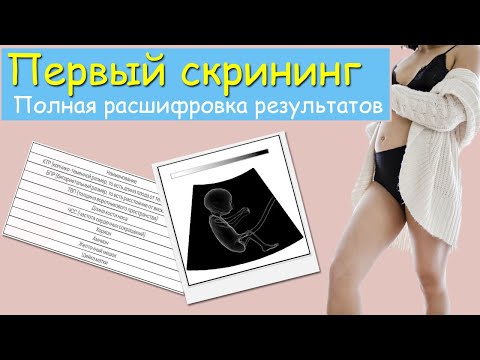 Первый скрининг. Полная расшифровка результатов узи и крови