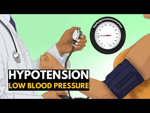 Low Blood Pressure or Hypotension, Causes, Signs and Symptoms, Diagnosis and Treatment.