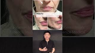 Smoker’s lines aren’t as simple as they look. screenshot 2