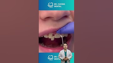 Liệu một chiếc răng đẹp thì có gì bất thường không? | Bác sĩ Cường