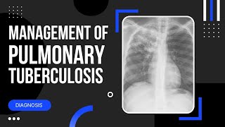 Pulmonary Tuberculosis